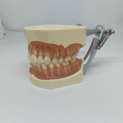 Studiemodel med Aftagelige Tnder 